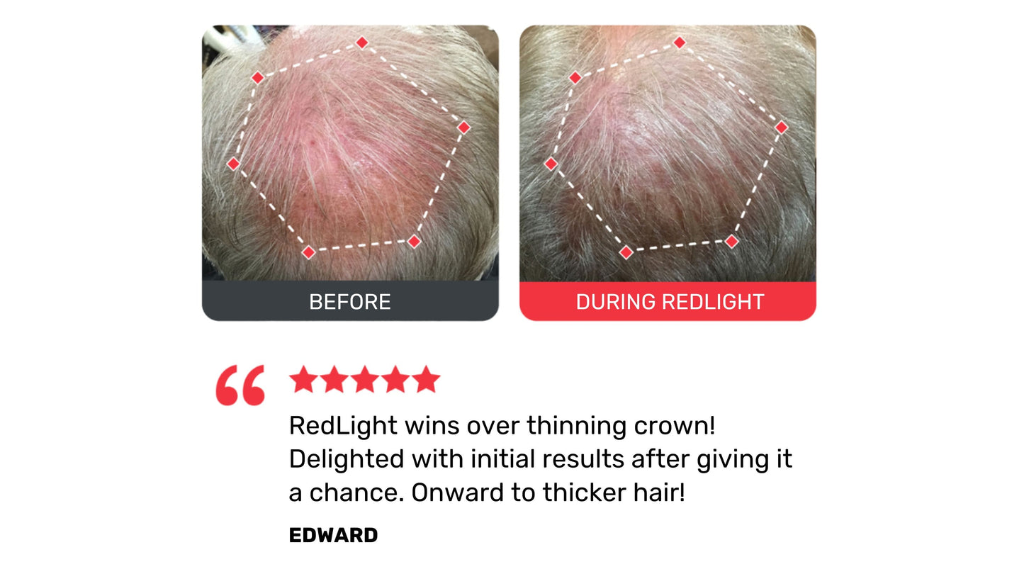 RedLight Hat Pro