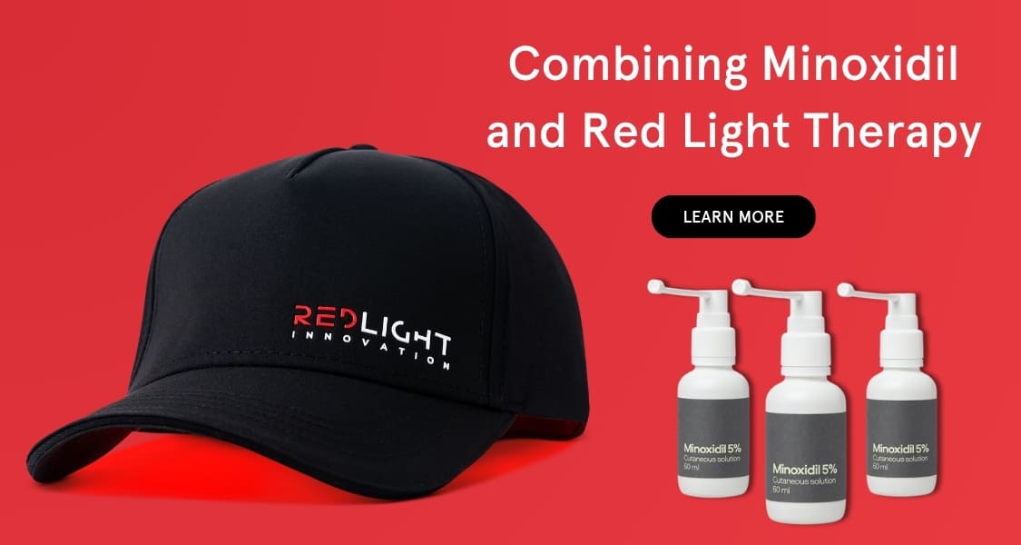 Banner graphic for 'Combining Minoxidil and Red Light Therapy', featuring a red light hair growth hat alongside three Minoxidil dropper bottles.