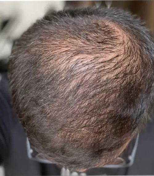 Jeff before