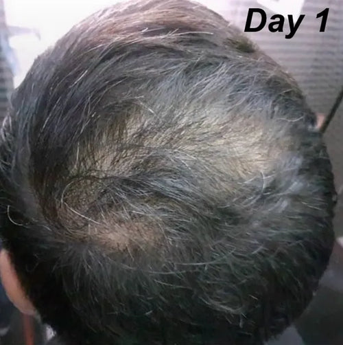 Umar C before