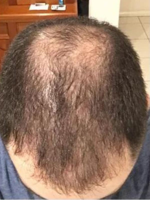 Musaf F. before