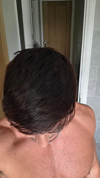 Aaron C after
