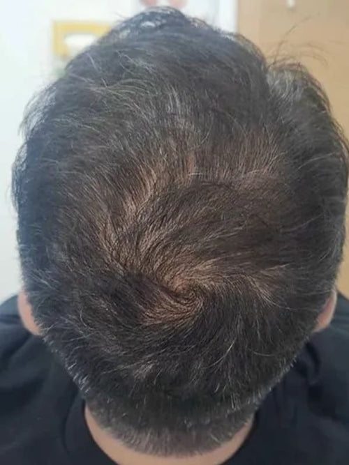 Sean S. before