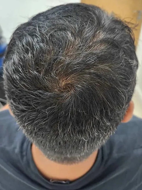 Sean S. after
