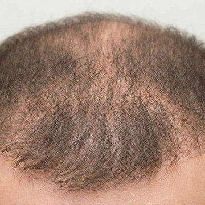 Stronger, fuller hair