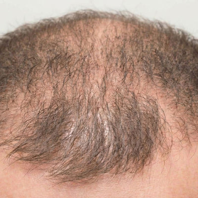 Regrowth accelerates