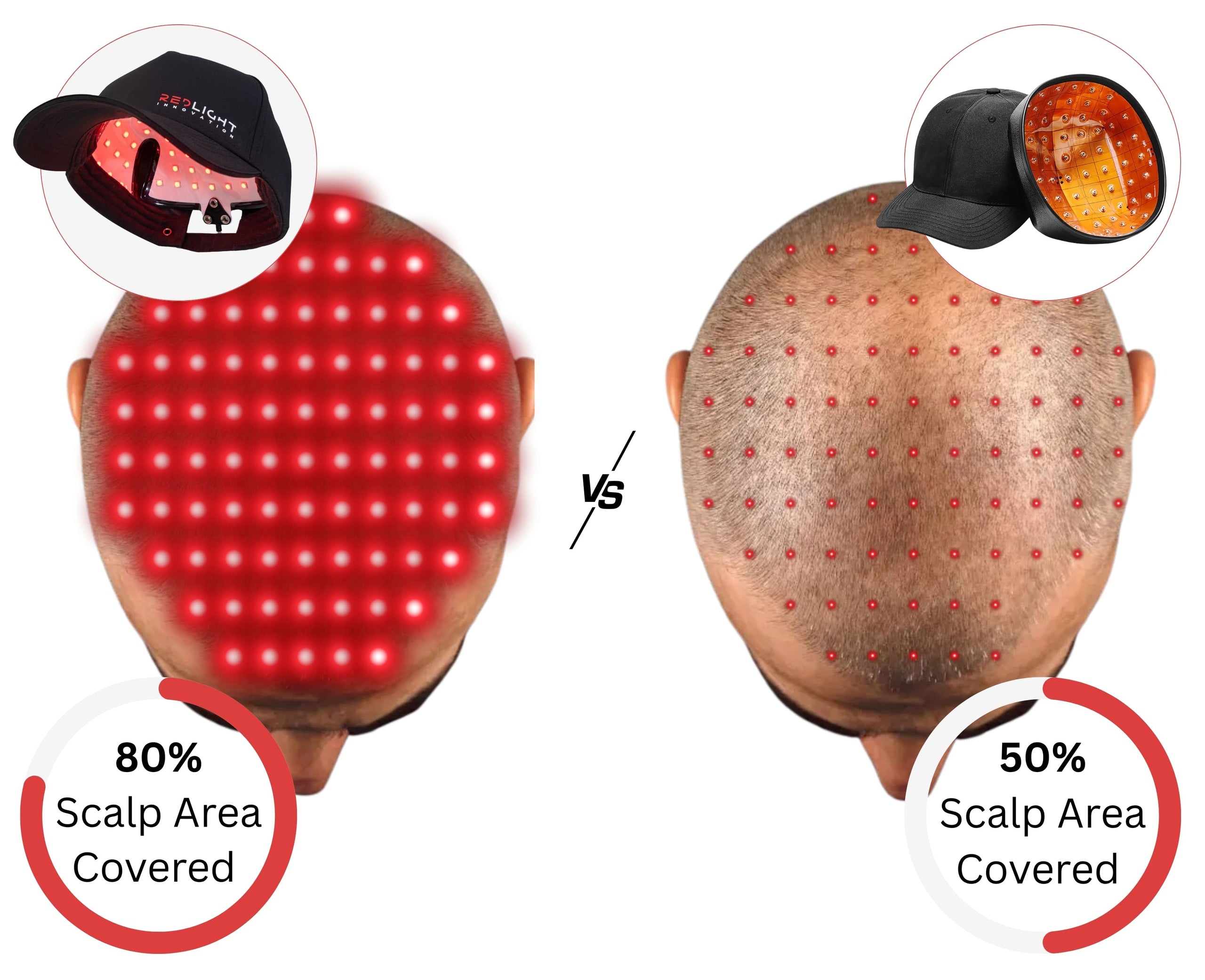 Comparison of two LED scalp massagers with red lights on a white background.