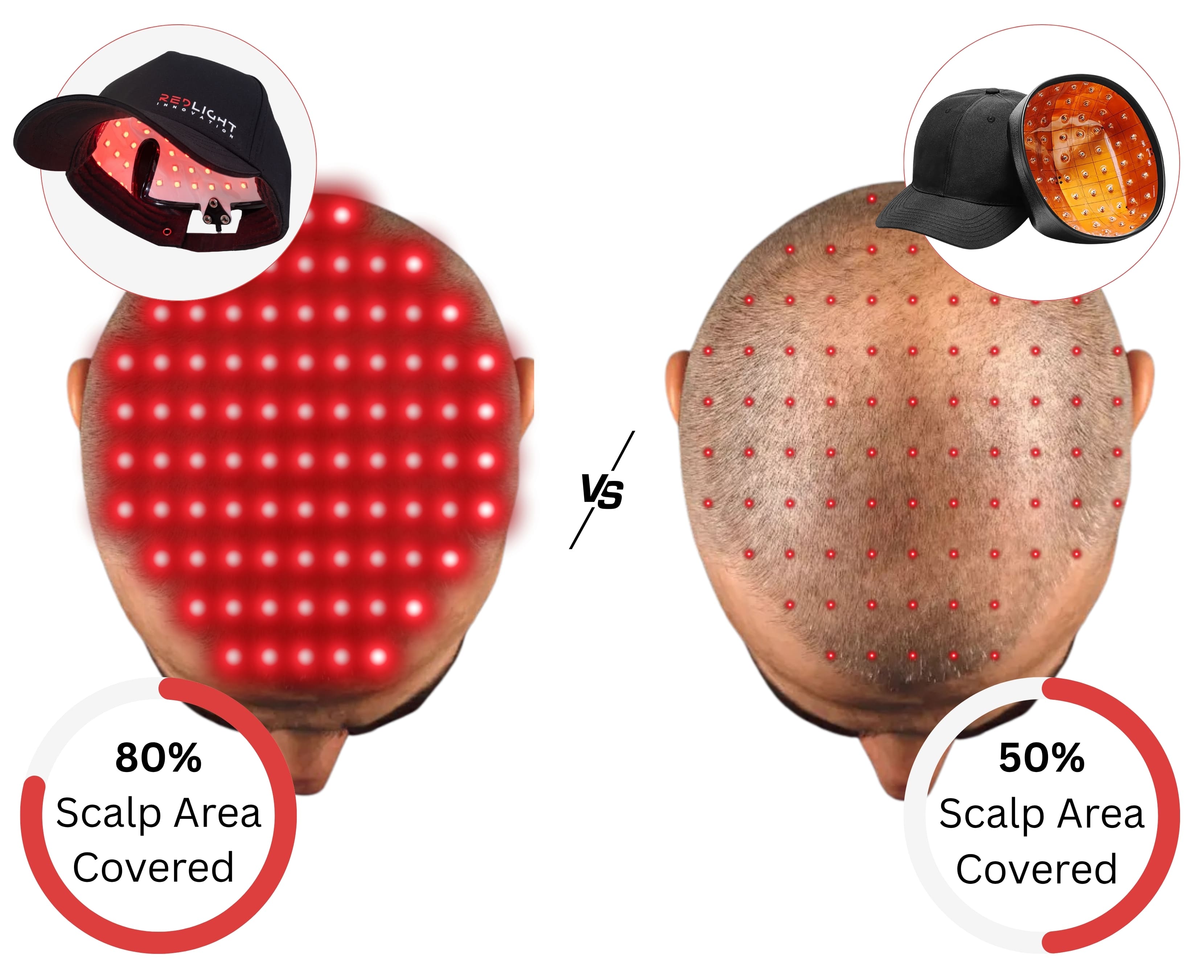 Comparison of two LED scalp massagers with red lights on a white background.