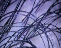 Scalp oil at day 90