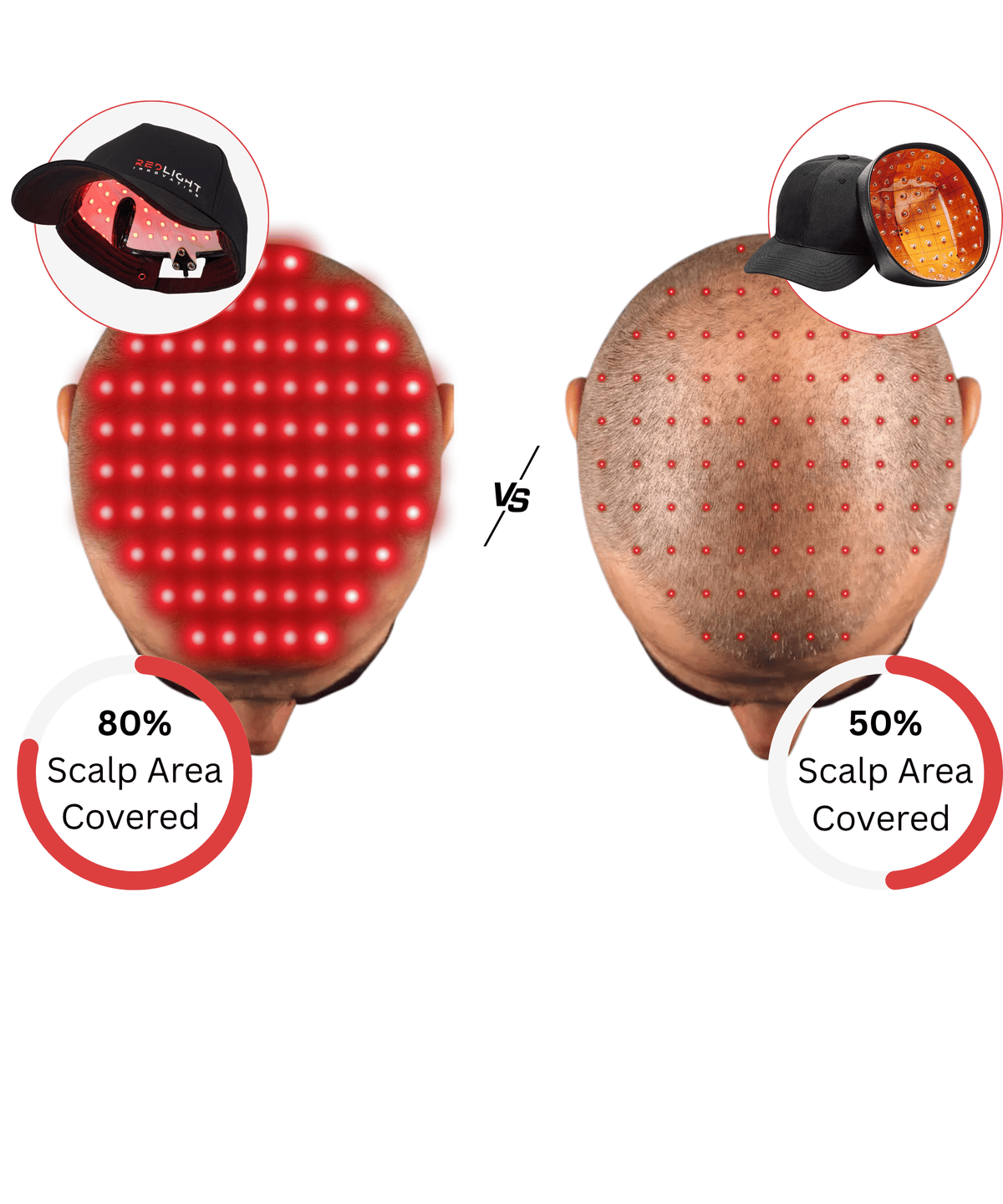 A comparison graphic showing two back views of a bald man's scalp with red light therapy dot patterns, labeled as 80% scalp area covered on the left and 50% scalp area covered on the right. Each includes a circular inset of the black cap with a red light panel.