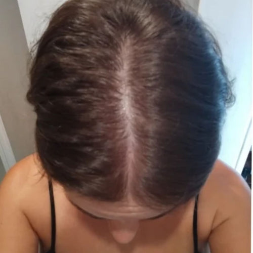 Jessica L. before