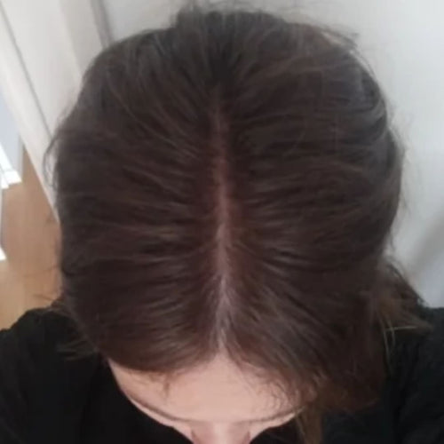 Jessica L. after