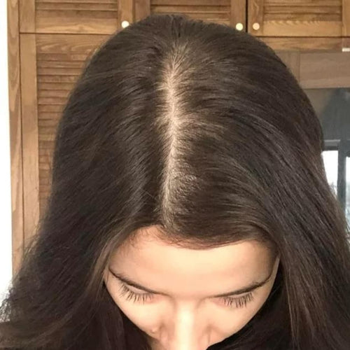 Olivia M. before