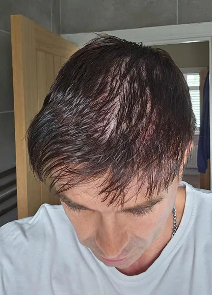 Aaron C before